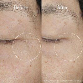 Tea Elixir Skin Resilience Activating Serum - mit Niacinamid & Hyaluronsäure