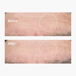 Hyaluronic Acid 2% + B5 - Feuchtigkeitsserum