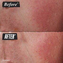 Ultra Facial Advanced Repair Barrier Cream