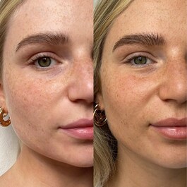 THE FACE - Self Tan Drops