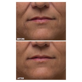 Alpha Beta® - Ultramildes Peeling für den Alltag