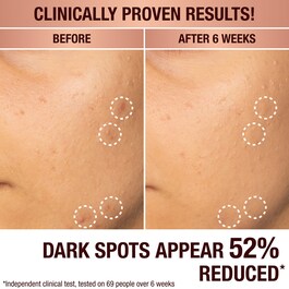 Dark Spot Correcting Radiance Recovery Serum - Serum gegen Flecken