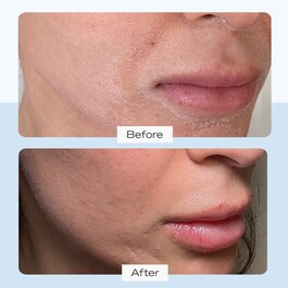 Ultra Repair Cream - Intensive Feuchtigkeitscreme für Gesicht und Körper
