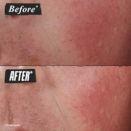 Ultra Facial Advanced Repair Barrier Cream