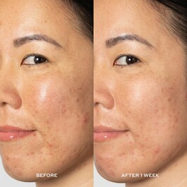 Glow 2OH Dark Spot Toner - Gesichtswasser für dunkle Flecken mit AHA