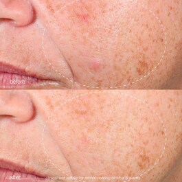 Retinol Clearing Oil - Pflegeöl für die Nacht