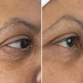 The Eye Cream - Die Augencreme
