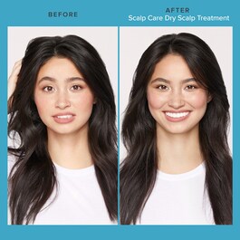 Scalp Care Dry Scalp Treatment - Ausgleichende Pflege für die Kopfhaut