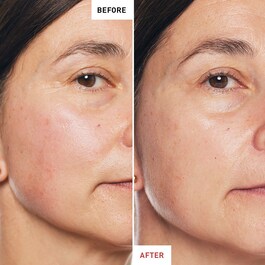 Skin Therapy Oil - Gesichtspflege-Öl