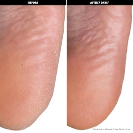 Peeling-Masken für die Füße - Peeling-Fußmasken