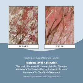 Scalp Revival - Micro Exfoliating Shampoo