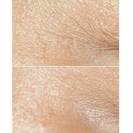 Smart Clinical Repair™ - Wrinkle Correcting Rich Cream