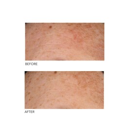 Alpha Beta® Peel Universal Formula