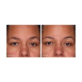 DermInfusions - Gel zur schnellen Regeneration