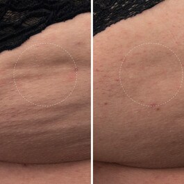 The Body Cream - Feuchtigkeitscreme für den Körper