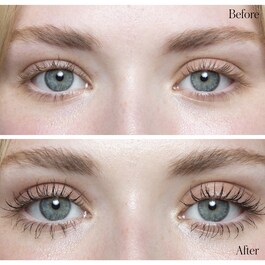 Duo Lift + Lumière Yeux - Duo für die Augen