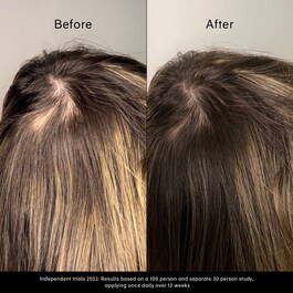 Pitta Growth Serum - Wachstumsserum