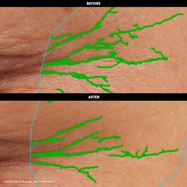 Lift & Firm - Glättende und Festigende Augenkonturencreme