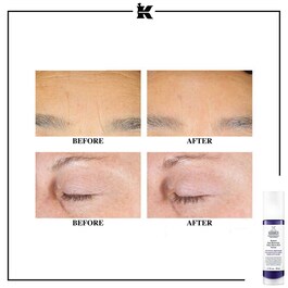 Retinol Micro-Dose Treatment - Serum