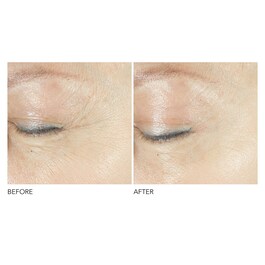 Advanced R + F Triple Correction - Eye Serum