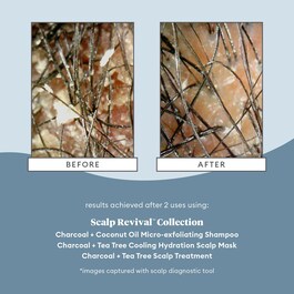 Scalp Revival - Micro Exfoliating Shampoo