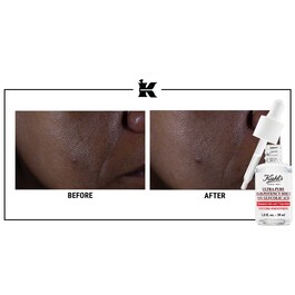 Pure Serum Glycolic Acid 10%