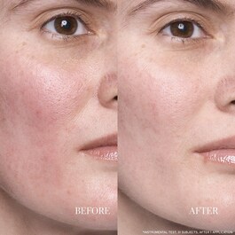Lotus Resurfacing Dream Serum - Anti-Aging-Nachtserum mit Lotus und AHAs
