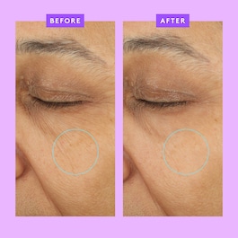 Ceramighty™ AF Eye Balm - Anti-Aging-Augenkonturencreme