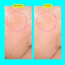 Bouncy Brightfacial™ - Aufhellende Maske