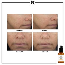 Powerful Strength Line Reducing - Concentrate Serum