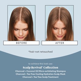 Scalp Revival - Camp Revival Charcoal Tea Tree Scalp