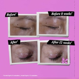 Super Multi Eye Zone Treatment - Anti-Aging Augencreme