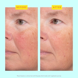 C-Luma™ Hydrabright Serum - Serum mit Vitamin C