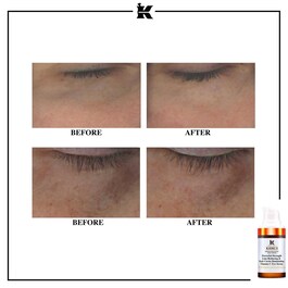 Powerful-Strenght Eye - Anti-Aging Augenserum