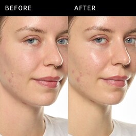 Ectoin Hydro-Barrier Serum - Feuchtigkeitsspendendes und schützendes Serum