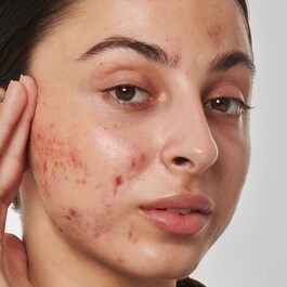 Lösung gegen Narben, Makel und Falten Retinol 1 % - Gesichtsserum