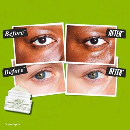 Creamy Eye Treatment With Avocado - Augencreme