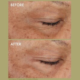 Pantscription Wrinkle Correction Eye Cream - with Encapsulated Retinol