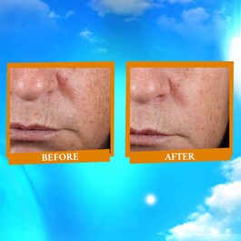 Ultra Light - Daily Defense SPF 50