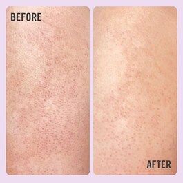 KP Bump Eraser Body Scrub with 10% AHA - Körper-Peeling mit AHAs