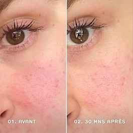 Evercalm™ Redness Relief Serum - Serum gegen Rötungen