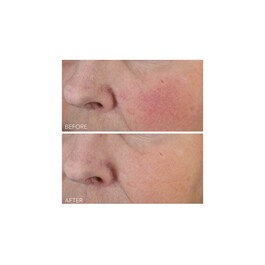 Vitamin C + Lactic - Intensive Feuchtigkeitspflege Straffung und Lifting