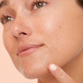 Acne Dots - Patchs Anti-Imperfections