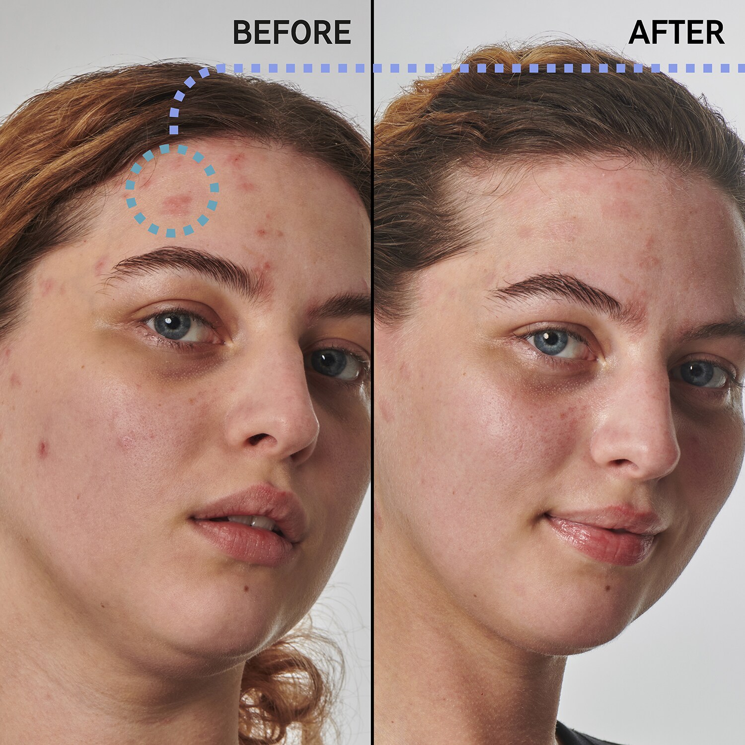 Lösung für trockene, raue Haut mit Urea 10 Gesichtsserum von THE INKEY LIST ≡ SEPHORA