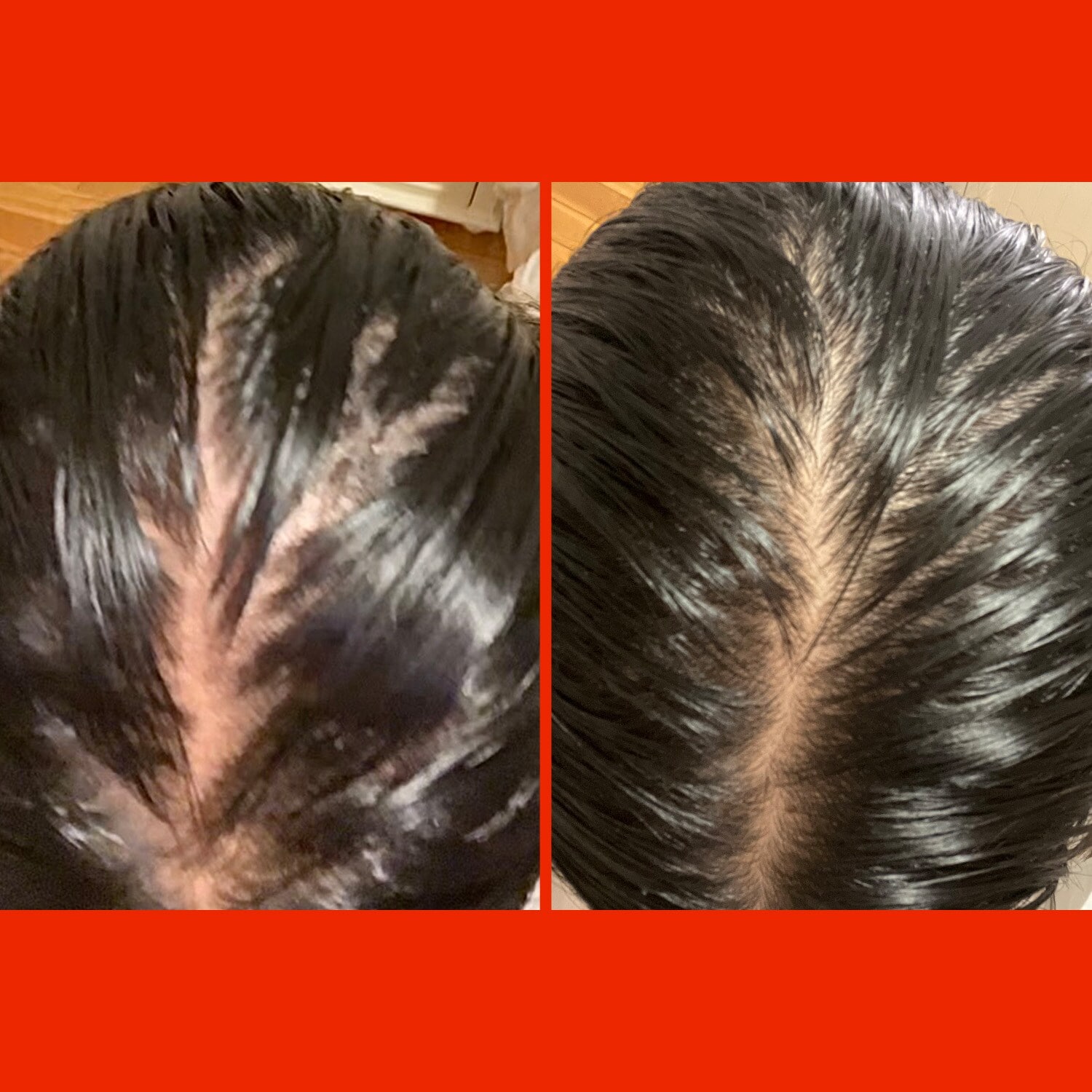 Mane Haarverdichtung Set – Shampoo, Conditioner & Thickener Spray Für Volleres Haar (Schwarz)