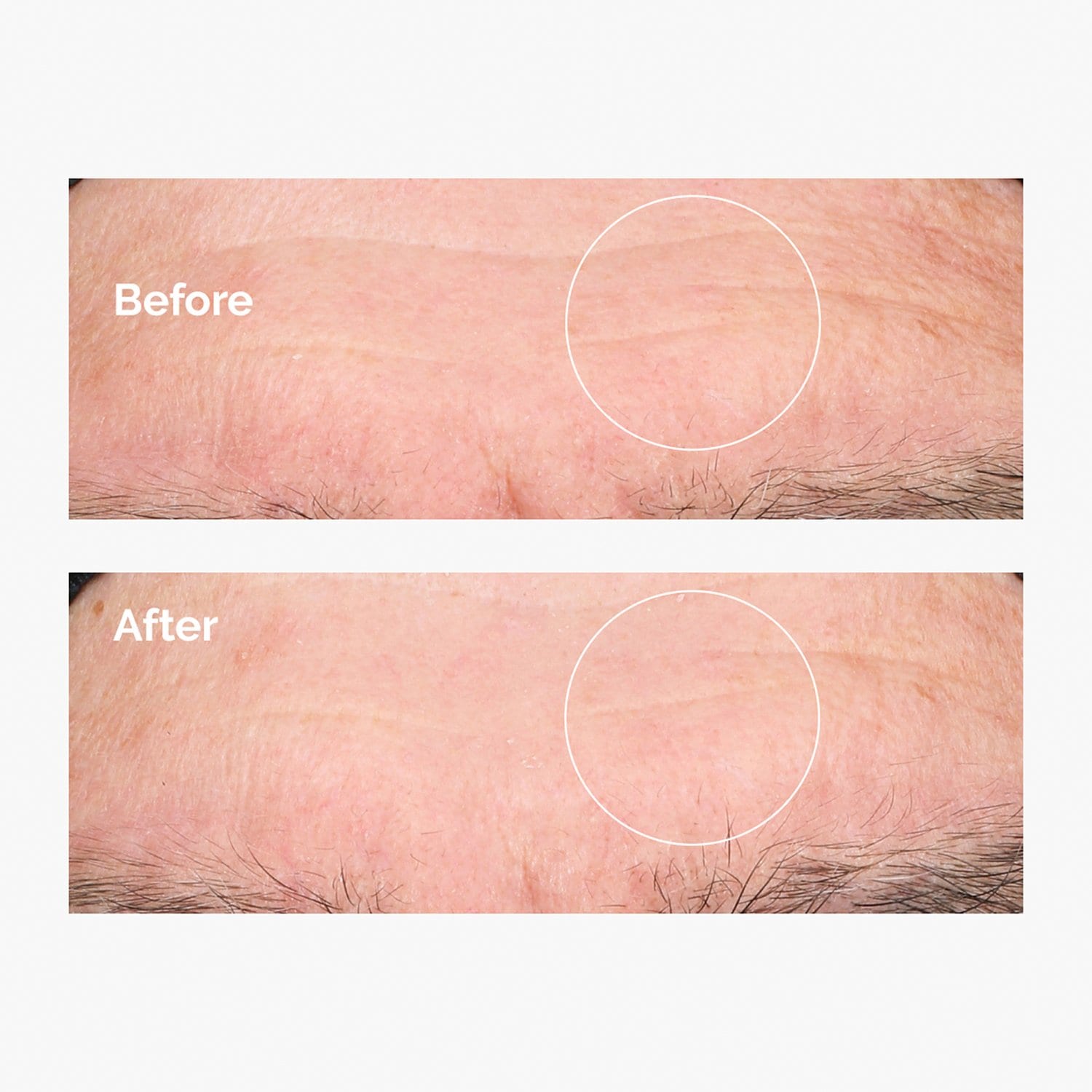 The Ordinary Hyaluronic Acid 2 B5 Inhaltsstoffe Hyaluronic Acid 2% + B5 - Feuchtigkeitsserum von THE ORDINARY ≡ SEPHORA