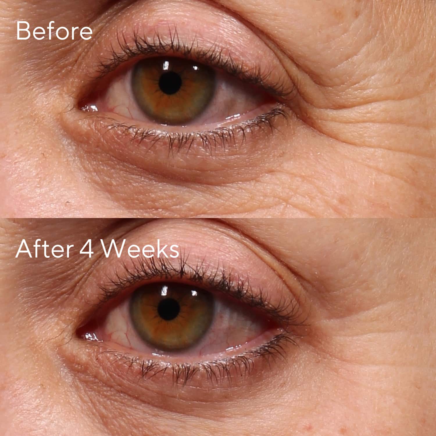Retinol Youth Verjüngendes RetinolSerum für die Augenkontur von MURAD ≡ SEPHORA